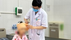 Trẻ bị chó nhà tấn công tại Hà Nội