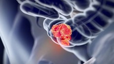 Ảnh minh hoạ. Nguồn: Source Biosciene