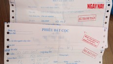 Phiếu đặt cọc và biên lai thu tiền xét nghiệm của bệnh viện Gangwhoo