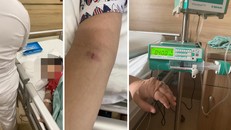 Cháu H. đang nằm điều trị tại bệnh viện, tay cháu H. bầm tím và liên tục truyền nước biển, 
