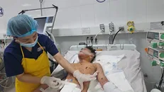 Một bệnh nhân bị chấn thương do pháo nổ. Ảnh TTXVN.