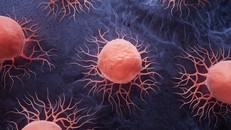 Thế giới đứng trước nguy cơ khủng hoảng về căn bệnh ung thư