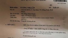 Thẩm phán bị tố đạp vào đùi đương sự