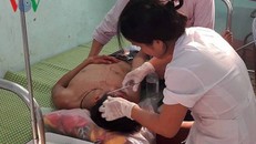 Học sinh bị đánh được các bác sĩ khâu vết thương tại bệnh viện.