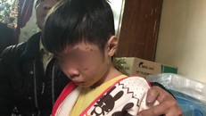 G.K bị mẹ kế và bố đẻ đánh đập dã man