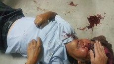 Ông Quang bị nhóm bảo vệ của SaiGon Metro Park hành hung dã man 