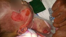 Bộ Y tế yêu cầu Sở Y tế Thanh Hóa làm rõ thông tin trẻ 15 tháng tử vong với nhiều vết thương lạ