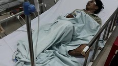 Một trong số các nạn nhân đang được điều trị tại bệnh viện Ảnh: CTV