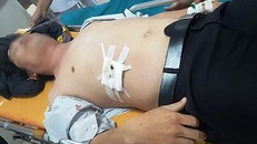 Vì nhắc nhở học sinh xóa hình xăm, thầy giáo bị học sinh dùng dao đâm thủng gan.