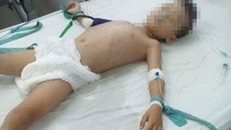 Tỷ lệ thương tích tạm thời Hiếu gây ra cho cháu L. là 63%.