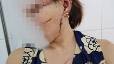 Nạn nhân Vũ Thị Oanh