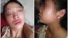 Nghi vấn vợ 16 tuổi đang mang thai bị bạo hành dã man, bị đuổi ra khỏi nhà