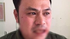 Tạm giữ người phụ nữ 'cò mồi' đánh nhân viên an ninh sân bay Nội Bài gãy 4 răng cửa