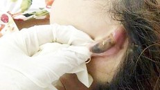 Tan nát nhan sắc vì làm đẹp