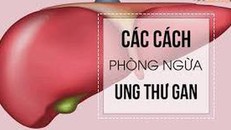 Ung thư gan: Khó chữa lành, có thể phòng tránh