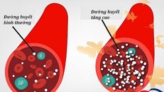 Kích hoạt đường huyết cao làm tăng nguy cơ tử vong ở bệnh nhân COVID-19