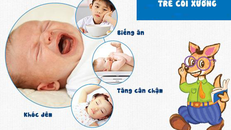 Dấu hiệu nhận biết trẻ bị còi xương ở trẻ.