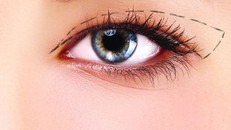 Mọi phẫu thuật ở vùng mắt đòi hỏi phải thật tinh vi để tránh hậu quả đáng tiếc. (Ảnh minh hoạ)