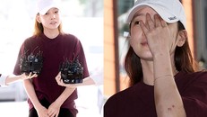 'Nữ thần' Goo Hara lộ mặt biến dạng, người đầy vết thương sau scandal bạo hành