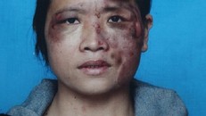 Vợ tố bị chồng bạo hành dã man vì bán hàng đa cấp 