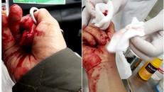 Nhà báo Đỗ Doãn Hoàng bị ba đối tượng lạ mặt dùng gậy đánh dã man