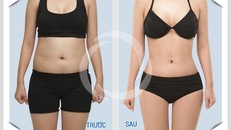 Bí quyết giảm mỡ bụng chuẩn, không biết bạn không thể đạt được