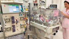 Bé sơ sinh bị ứ độc NH3 được cứu sống sau hai ngày lọc máu liên tục 