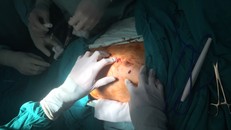 Nhờ quy trình báo động đỏ liên viện, anh T. đã được cứu sống