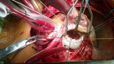 Tài xế vỡ tim sau cúp phanh gấp, đập ngực vào vô lăng