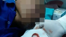 Người đàn ông suýt chết vì nắp chai nhựa kẹt giữa cuống họng