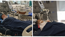 Thêm 3 trẻ đang nguy kịch, suy đa tạng vì ong đốt