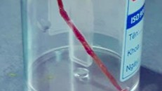 Chiếc tăm tre dài 6cm đâm thủng ruột bệnh nhân