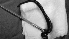 Người đàn ông bị vắt rừng ‘làm tổ’ trong cuống họng