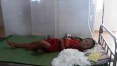 Cháu bé được điều trị tại bệnh viện - Ảnh: Zing