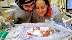 Sinh non nặng vẻn vẹn 450 gam và 'không có ruột', cậu bé vẫn sống sót kỳ diệu