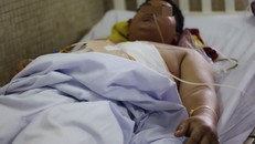 Cứu sống bệnh nhân bị đâm ở ngực, mất hai lít máu