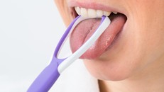 Phát hiện ung thư nhờ… kiểm tra lưỡi