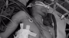 Cứu sống kịp thời nam thanh niên bị đâm thủng tim, gan