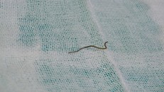 Ăn thịt gà nướng, nam thanh niên nuốt cả dây thép