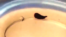 Con vắt dài 5cm sống trong mũi người phụ nữ