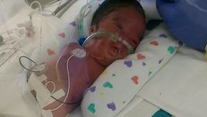 Mẹ vẫn quyết sinh con dù biết em bé không có chân tay