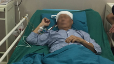 Đang phẫu thuật não, cụ ông vẫn 'tám chuyện' với bác sĩ như thường