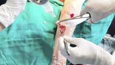 Cụ bà bị chó béc-giê tấn công với hơn 30 vết thương