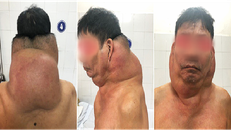 Bệnh nhân trước khi phẫu thuật - Ảnh: VTV