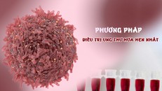 Những phương pháp điều trị ung thư hứa hẹn nhất ​