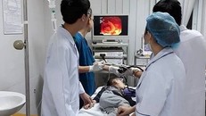 Gắp đinh vít ra khỏi thực quản bệnh nhi 5 tuổi