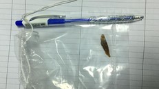 Mảnh xương heo dài 3cm được gắp từ trong ruột non của ông D - Ảnh: BVCC