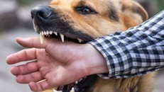 Cả nhà bị chó dại cắn, 2 bố con tử vong