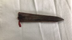 Cứu người đàn ông bị mũi cá kiếm đâm thủng ngực