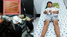 Ngủ quên, bé trai 7 tuổi nuốt cả que nhựa kẹo mút vào họng